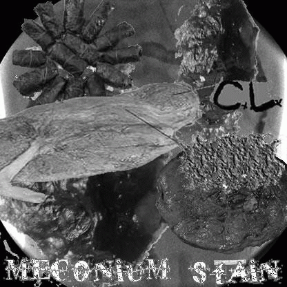 Anal Cake : Meconium Stain